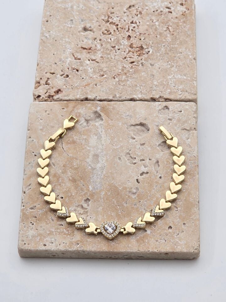 XUPING Armband // WRIST-6174